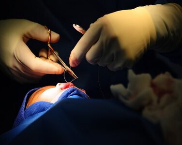 craniofacial
