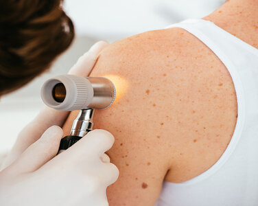 dermotology
