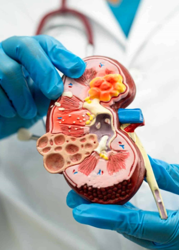 Nephrologist in Dharmapuri